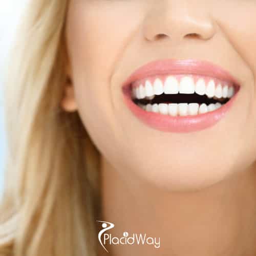 The 'Saigon Smile': How 2026's AI-Powered Digital Smile Design is Attracting a Record Number of UK and European Patients Seeking Hollywood Veneers